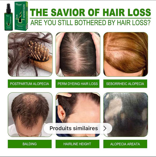 Oïl Pousse Cheveux, Spray anti-chute, Pousse Cheveux très Rapide, Traitements Pour la Repousse des Cheveux,Favorise la Pousse des Cheveux, Vert, inodore,Topical Hair