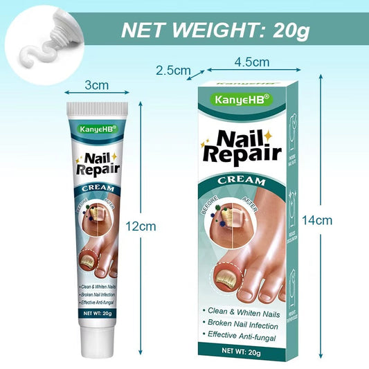 20g Crème de Soin des Ongles, Nourrissant et Renforce pour Ongles, Réparation D’ongle Pour Les Ongles Décolorés Épaissis Émiettés Cassés