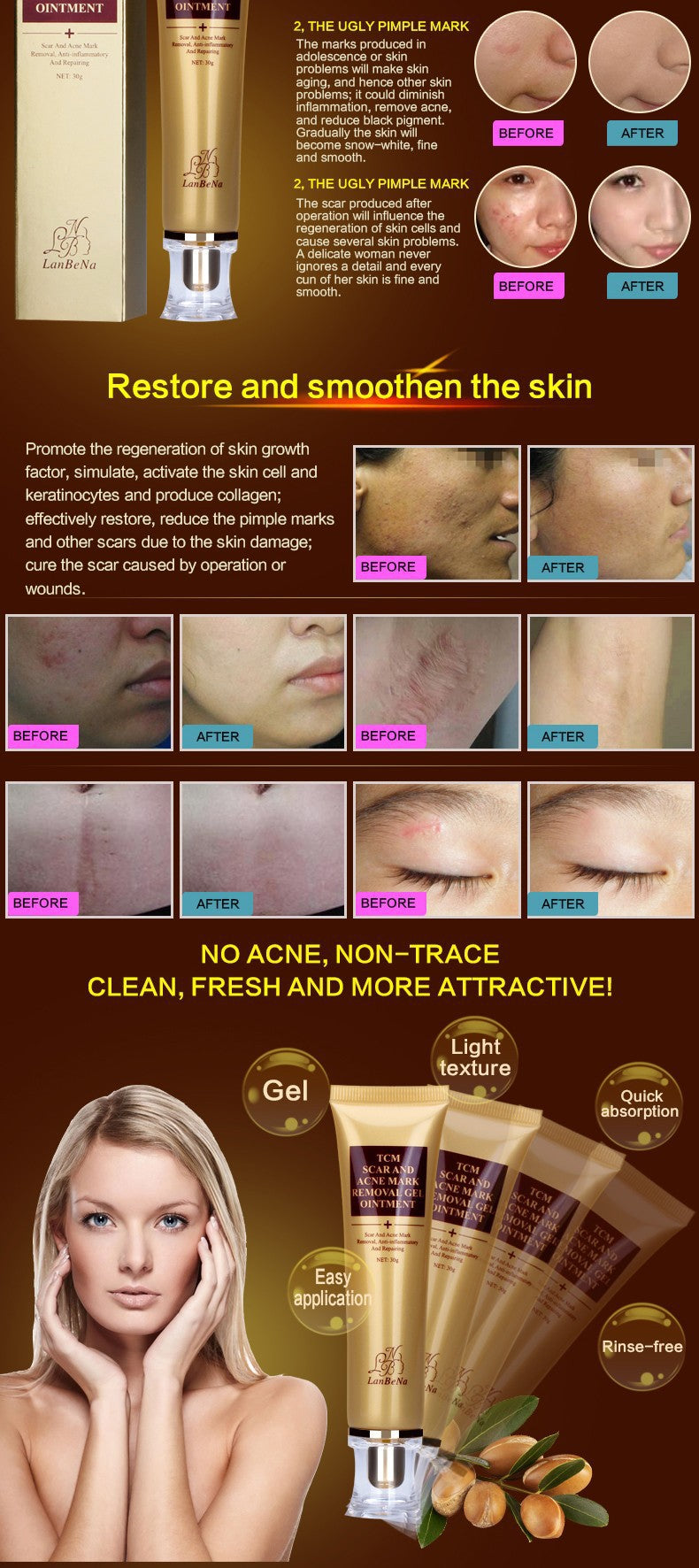Tcm cicatrice et acné mark removal