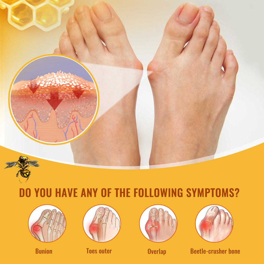 Cream New Zeland,Meniscus Pain Relief au venin d'abeille pour arthrites, Gel de soin professionnel au venin d'abeille de nouvelle-zélande