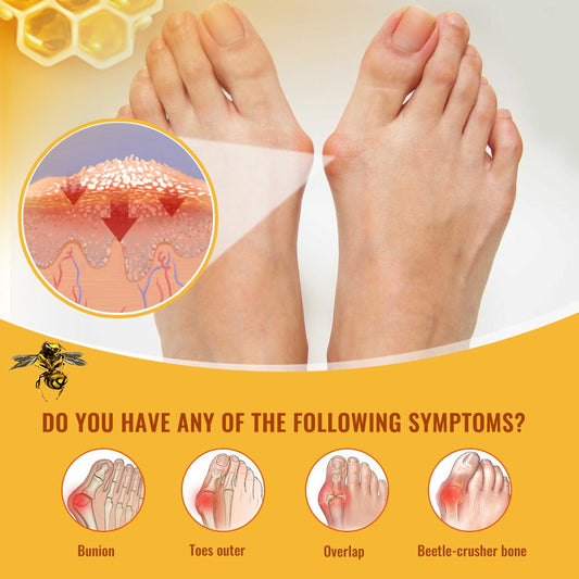 Cream New Zeland,Meniscus Pain Relief au venin d'abeille pour arthrites, Gel de soin professionnel au venin d'abeille de nouvelle-zélande
