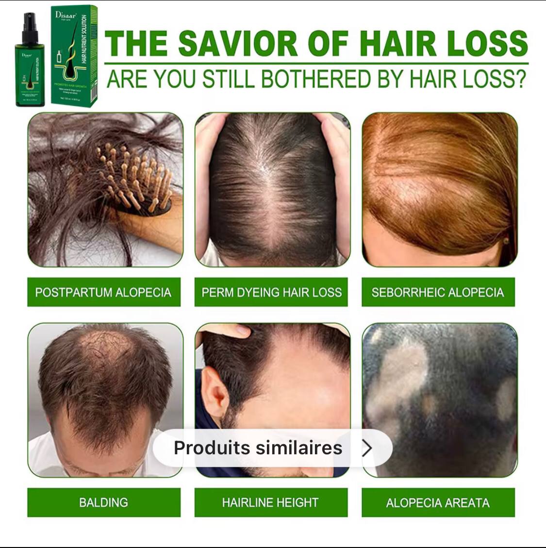 Oïl Pousse Cheveux, Spray anti-chute, Pousse Cheveux très Rapide, Traitements Pour la Repousse des Cheveux,Favorise la Pousse des Cheveux, Vert, inodore，Topical Hair
